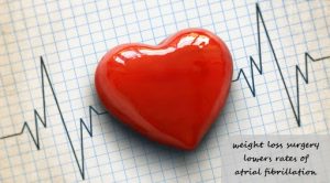 weight loss surgery and lower rates of atrial fibrillation