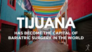 Tijuana Capital of Bariatric Surgery in The World - Mexico Bariatric Center