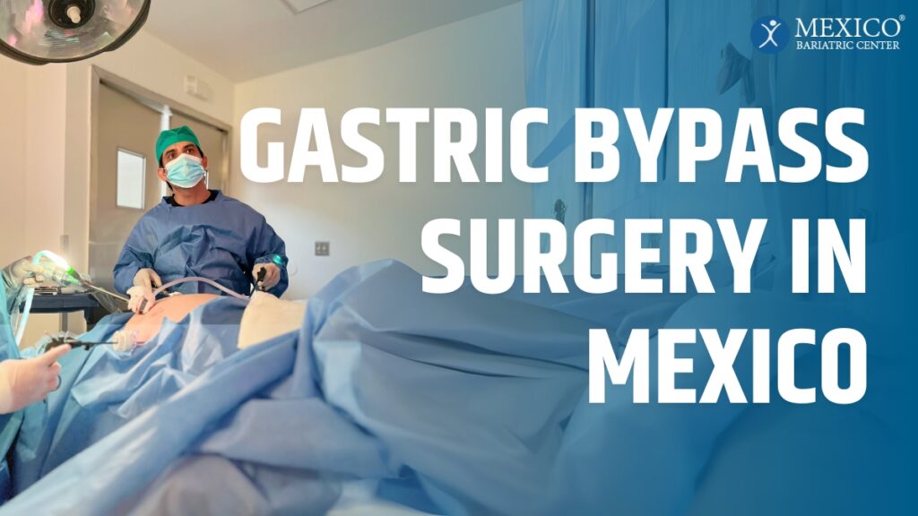 Gastric Bypass Surgery in Mexico